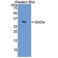 Interferon Regulatory Factor 6 (IRF6) Antibody