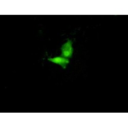 Interferon Regulatory Factor 6 (IRF6) Antibody