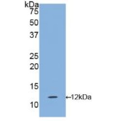 Interleukin 1 Receptor Type I (IL1R1) Antibody