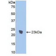 Western blot analysis of recombinant Rat IL1R1.