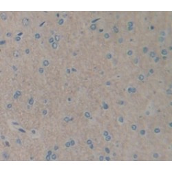 Interleukin 1 Receptor Type I (IL1R1) Antibody