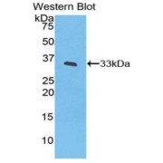 Western blot analysis of recombinant Human IL20Rb Protein.