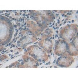 Interleukin 20 Receptor Beta (IL20Rb) Antibody