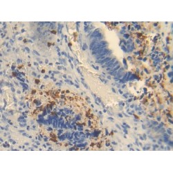 Ornithine Carbamoyltransferase, Mitochondrial (OTC) Antibody