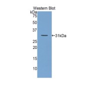 Western blot analysis of the recombinant protein.