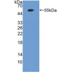 Phosphatase And Tensin Homolog (PTEN) Antibody