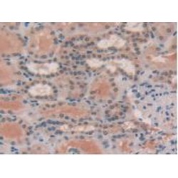 Phosphatase And Tensin Homolog (PTEN) Antibody