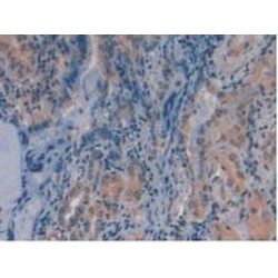 Phosphatase And Tensin Homolog (PTEN) Antibody