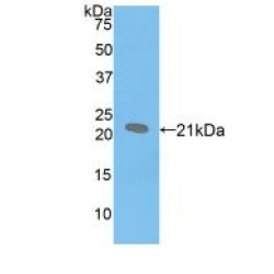 Pulmonary Surfactant-Associated Protein B (SFTPB) Antibody