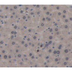 Pulmonary Surfactant-Associated Protein C (SFTPC) Antibody