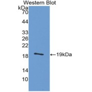 Western blot analysis of the recombinant protein.