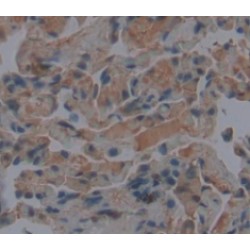 Calcitonin Gene Related Peptide 2 / CGRP2 (CALCB) Antibody