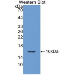 Calcitonin Gene Related Peptide 2 / CGRP2 (CALCB) Antibody