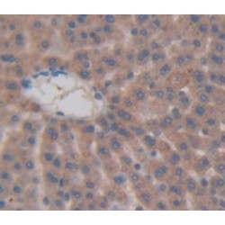 Calcitonin Gene Related Peptide 2 / CGRP2 (CALCB) Antibody