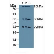 Western blot analysis of (1) Human HeLa cells, (2) Human Jurkat Cells and (3) Human MCF7 Cells.