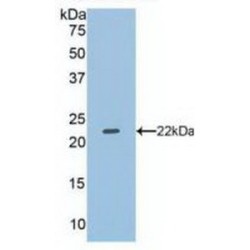 Dual Specificity Phosphatase 3 (DUSP3) Antibody