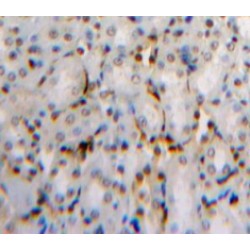 Dual Specificity Phosphatase 3 (DUSP3) Antibody