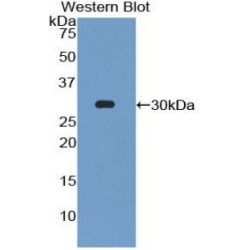 Early Growth Response 4 (EGR4) Antibody