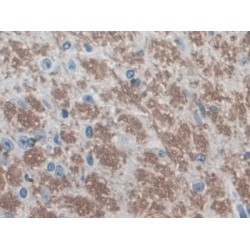 Early Growth Response 4 (EGR4) Antibody