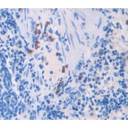 Factor Related Apoptosis Ligand (FASL) Antibody