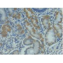 Factor Related Apoptosis Ligand (FASL) Antibody