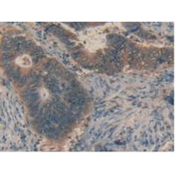 Factor Related Apoptosis Ligand (FASL) Antibody