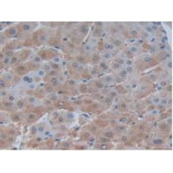 Factor Related Apoptosis Ligand (FASL) Antibody