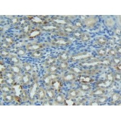 Factor Related Apoptosis Ligand (FASL) Antibody