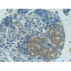 Factor Related Apoptosis Ligand (FASL) Antibody