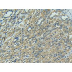 Factor Related Apoptosis Ligand (FASL) Antibody