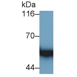 Glial Fibrillary Acidic Protein (GFAP) Antibody