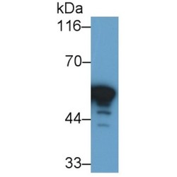 Glial Fibrillary Acidic Protein (GFAP) Antibody