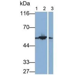 Glial Fibrillary Acidic Protein (GFAP) Antibody