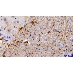 Glial Fibrillary Acidic Protein (GFAP) Antibody