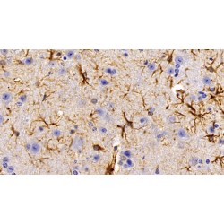 Glial Fibrillary Acidic Protein (GFAP) Antibody