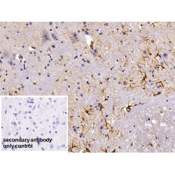 Glial Fibrillary Acidic Protein (GFAP) Antibody