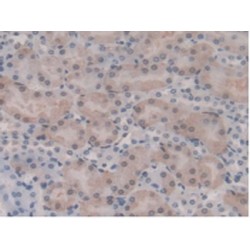 Glutathione S Transferase Mu 1 (GSTm1) Antibody