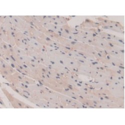 Glutathione S Transferase Mu 1 (GSTm1) Antibody