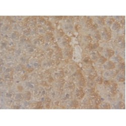 Glutathione S Transferase Mu 1 (GSTm1) Antibody