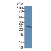 Western blot analysis of Human Liver lysate, using Human GSTm4 Antibody (2 µg/ml) and HRP-conjugated Goat Anti-Rabbit antibody (<a href="https://www.abbexa.com/index.php?route=product/search&amp;search=abx400043" target="_blank">abx400043</a>, 0.2 µg/ml).