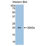 Western blot analysis of the recombinant protein.