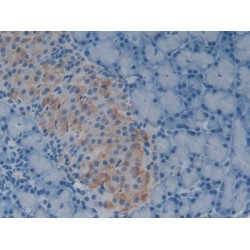 Growth Differentiation Factor 1 (GDF1) Antibody