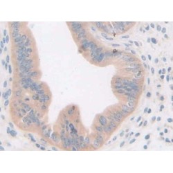 Growth Differentiation Factor 5 (GDF5) Antibody