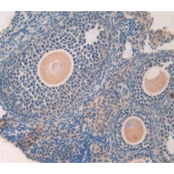 Growth Differentiation Factor 5 (GDF5) Antibody