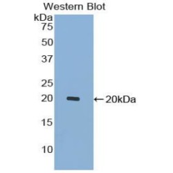 Growth Differentiation Factor 7 (GDF7) Antibody