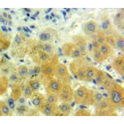 Growth Differentiation Factor 7 (GDF7) Antibody