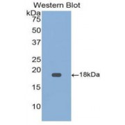 Western blot analysis of the recombinant protein.