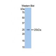Western blot analysis of recombinant Human KNG1/HMWK Protein.