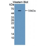 Western blot analysis of recombinant HMWK.