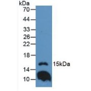 Western blot analysis of Mouse Lung Tissue.